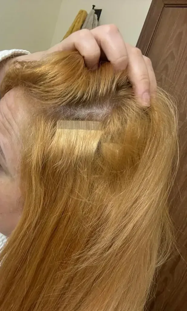 Image #1 from Chloe